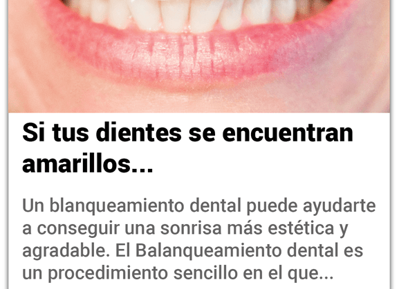 Blanqueamientos dentales de Ríe Genial Clínica Dental